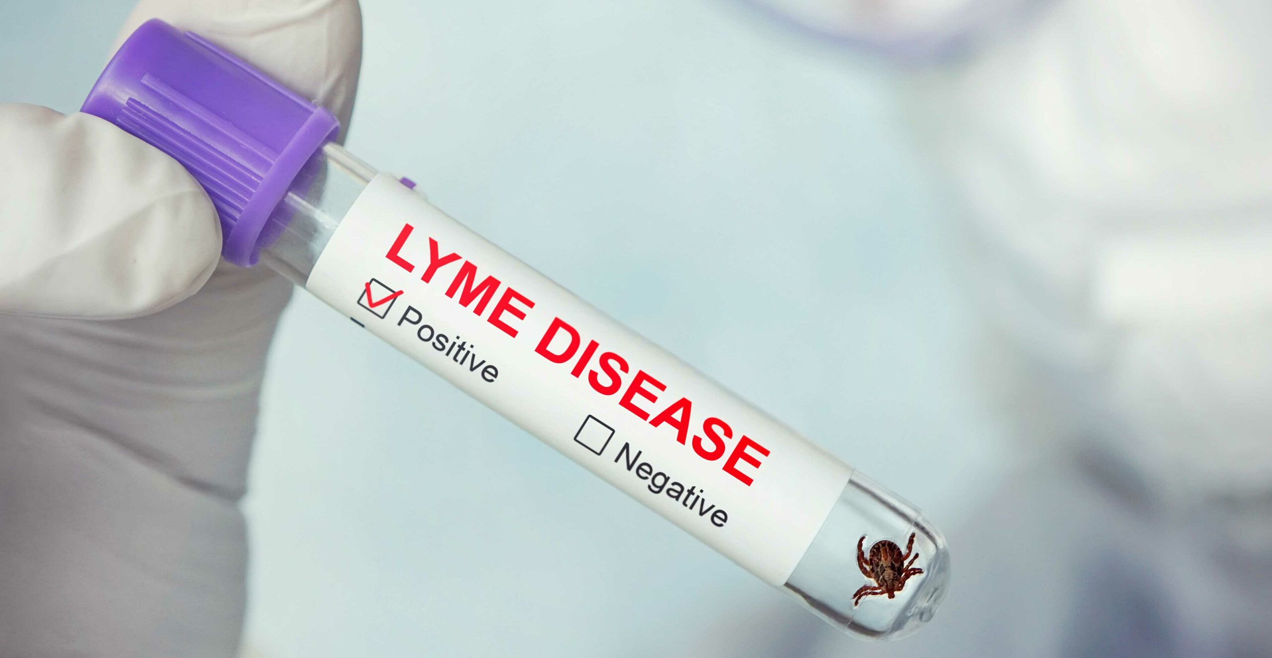Combating Lyme Disease with Integrative Medicine in Springfield Missouri