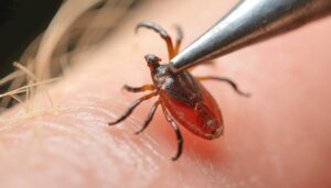 Functional Medicine Treatments For Lyme Disease And Other Tick Borne Illnesses