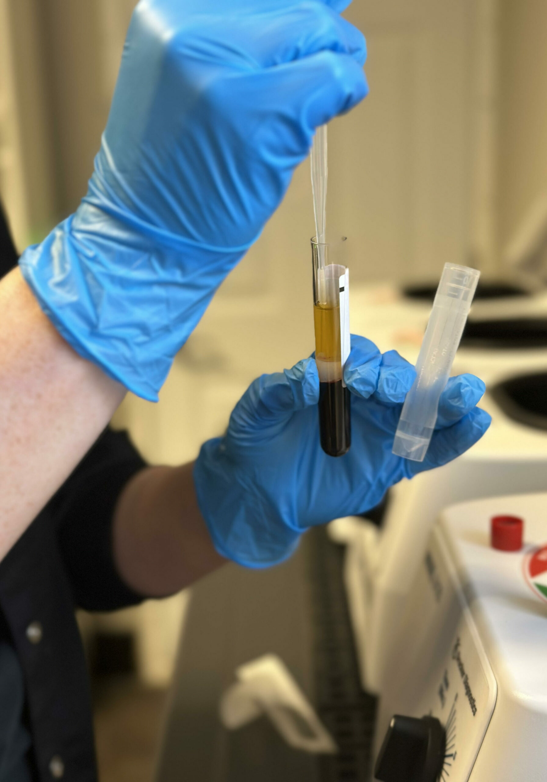 Blood-Analysis-in-Springfield-Missouri