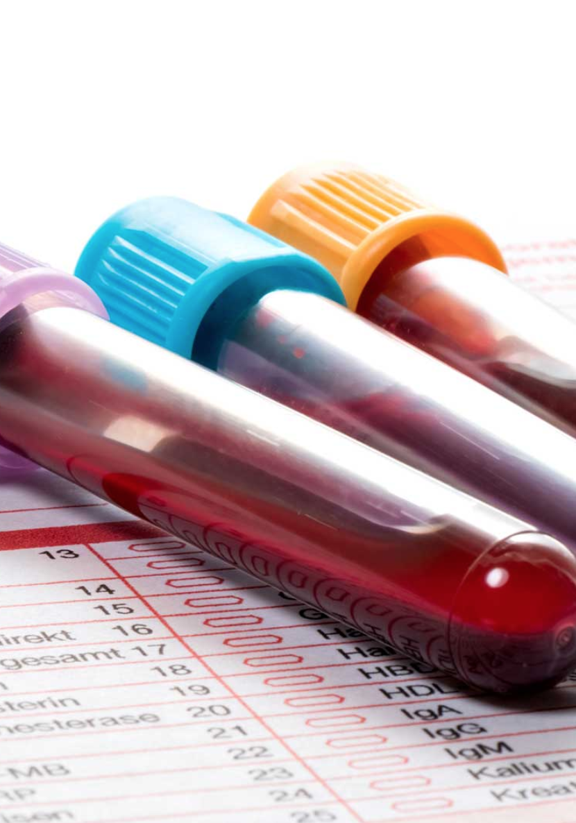 Blood-Testing-Springfield-Missouri