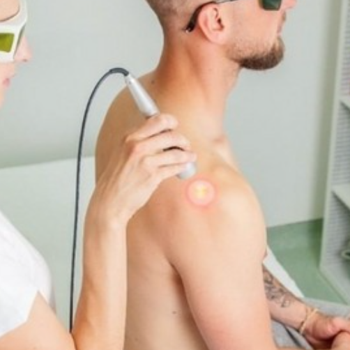 Shoulder-Back-Pain-Infrared-Laser-In-Springfield-Missouri